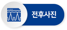 전후사진